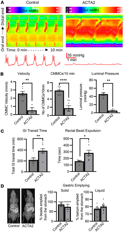 Colonic dysmotility in ACTA2 mutant mice.
(A) Representative spatiotempo...
