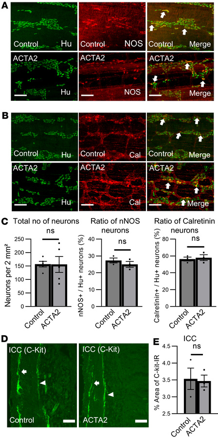 Enteric nervous system in ACTA2 mutant mice.
(A and B) Morphometric anal...