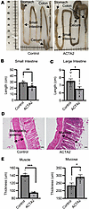 Altered gut architecture in ACTA2 mutant mice.