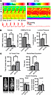 Colonic dysmotility in ACTA2 mutant mice.