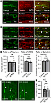 Enteric nervous system in ACTA2 mutant mice.