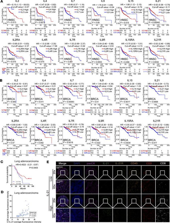 Expression of IL21 in the TME is correlated with favorable prognosis of ...