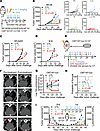 Exogenous administration of IL-21 synergistically enhances the antitumor ef