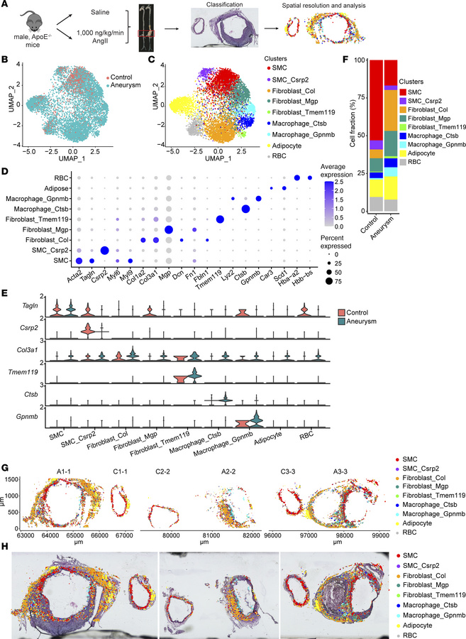Single-cell spatial transcriptomic profiling of normal and aneurysmal ab...