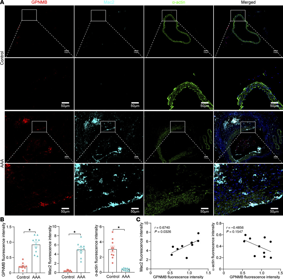 Immunofluorescent staining confirms the interaction of SMC and GPNMB-hig...