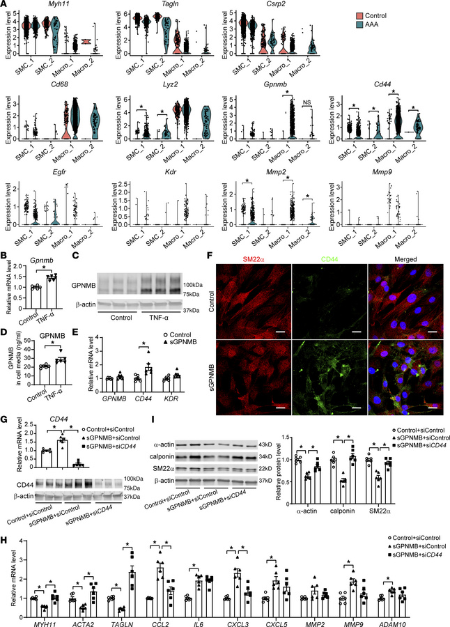 Macrophage-secreted GPNMB promotes SMC phenotypic switching.
(A) Violin ...
