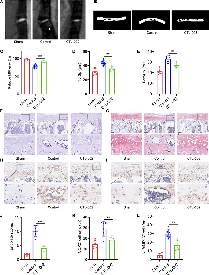 Targeting GDF15 alleviates the early endplate degeneration.
(A and C) T2...