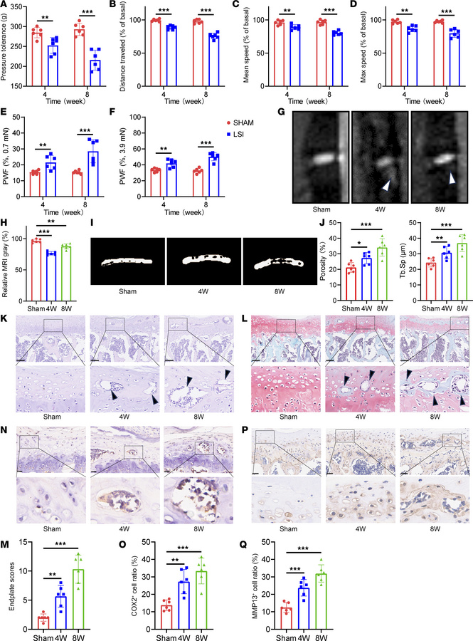 Lumbar spine instability induces early endplate degeneration in mice.
(A...