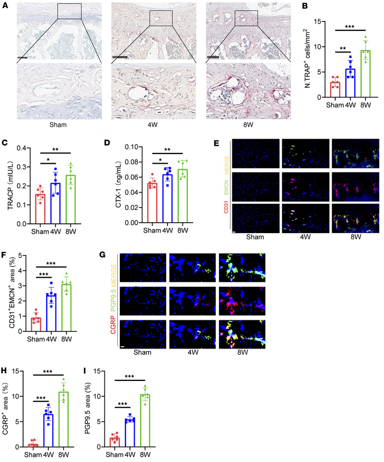 Osteoclastogenesis is overactivated in the endplates of LSI mice.
(A) Re...