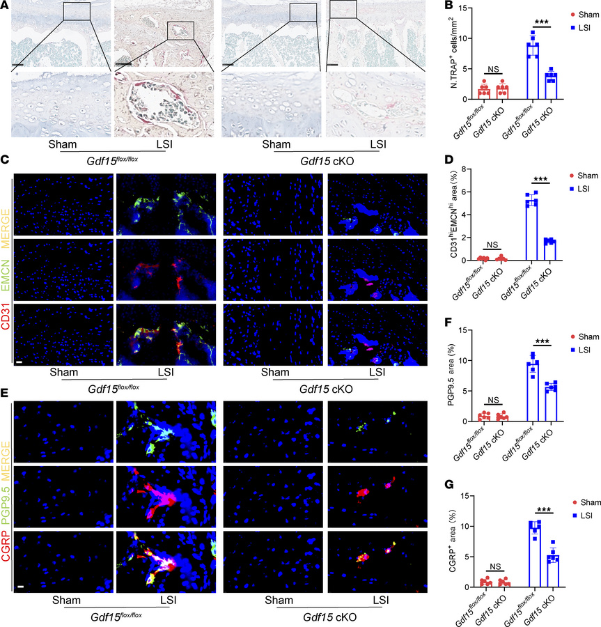 Conditional knockout of Gdf15 inhibits osteoclastogenesis in the endplat...