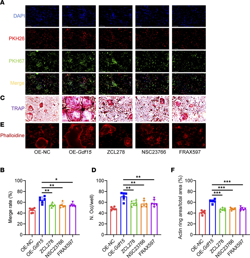 Inhibition of Rho GTPases alleviates osteoclast overactivation induced b...