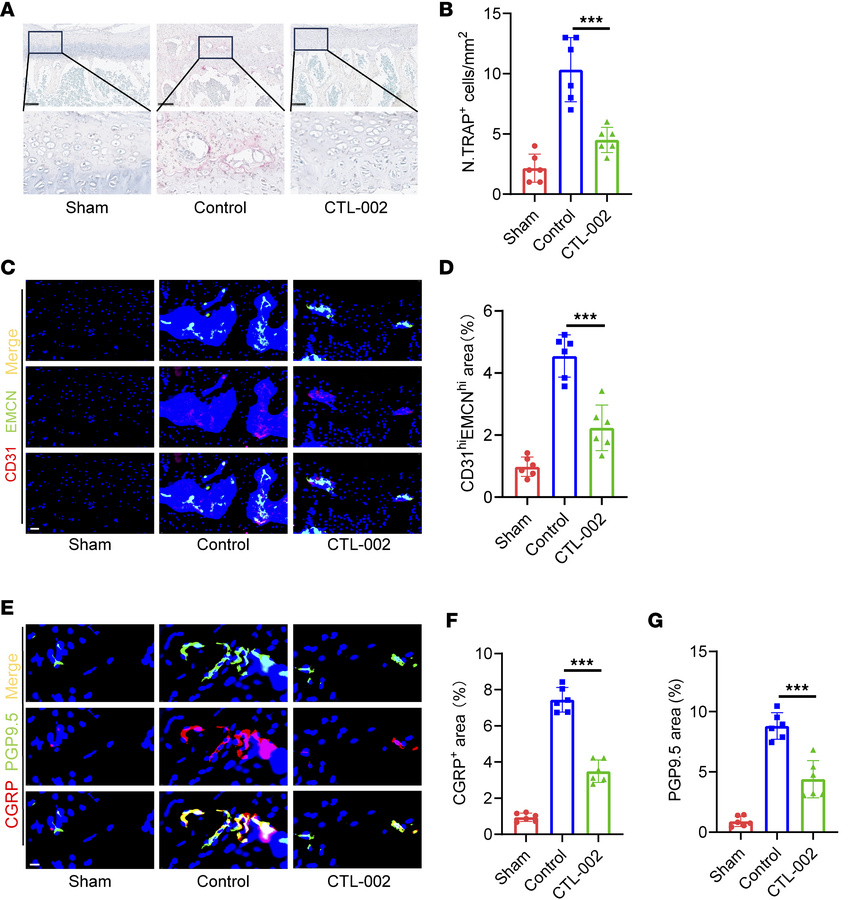 Targeting GDF15 suppresses the overactivation of osteoclastogenesis in t...