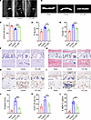 Targeting GDF15 alleviates the early endplate degeneration.
