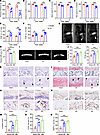 Lumbar spine instability induces early endplate degeneration in mice.