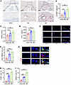Osteoclastogenesis is overactivated in the endplates of LSI mice.