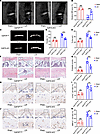 Conditional knockout of Gdf15 attenuates endplate degeneration in mice.