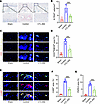 Targeting GDF15 suppresses the overactivation of osteoclastogenesis in the