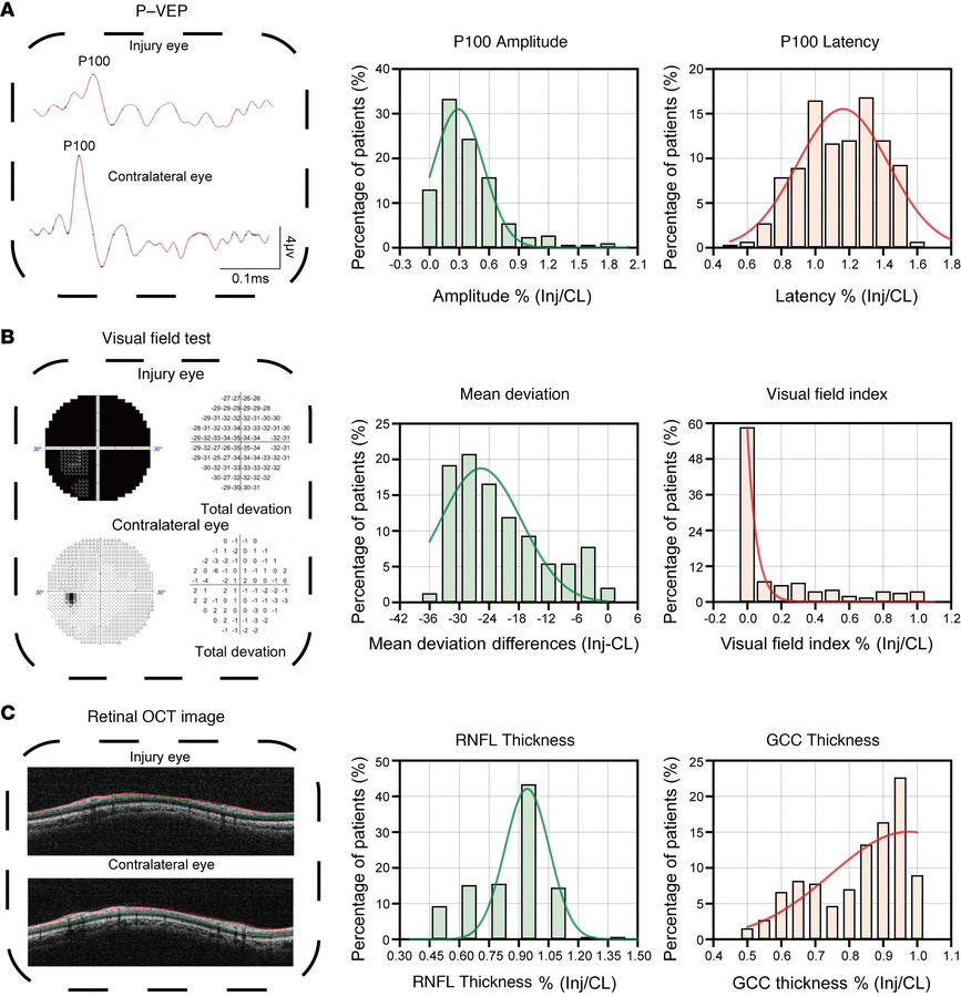 Distribution of functional and structural deficits in patients with mono...