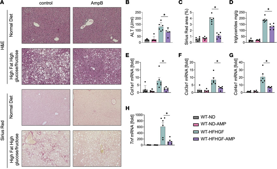 Amphotericin B ameliorates MASLD.
(A) H&amp;E and Sirius red staining of...