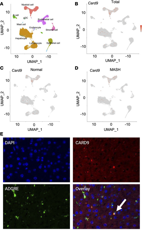 
CARD9 expression is found in a subset of human liver and murine macroph...