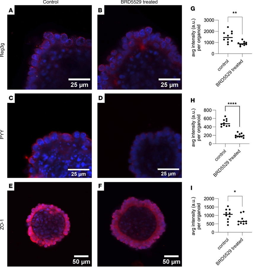 CARD9 inhibition leads to reduced expression of Reg3g in WT small intest...