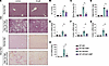 Amphotericin B ameliorates MASLD.