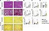 CARD9 deficiency exacerbates MASLD.