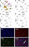 CARD9 expression is found in a subset of human liver and murine macrophages