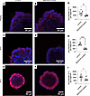 CARD9 inhibition leads to reduced expression of Reg3g in WT small intestina