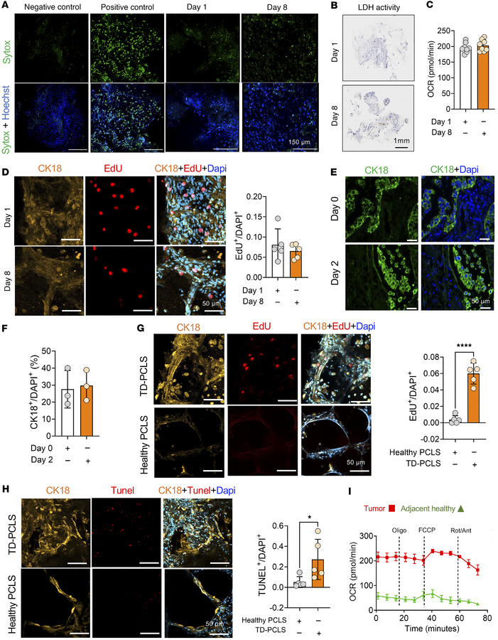 TD-PCLS is a dynamic and vital heterogeneous ecosystem.
(A) Sytox (green...