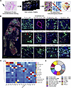 Multiplex IF and multispectral imaging show distribution of structural, fun