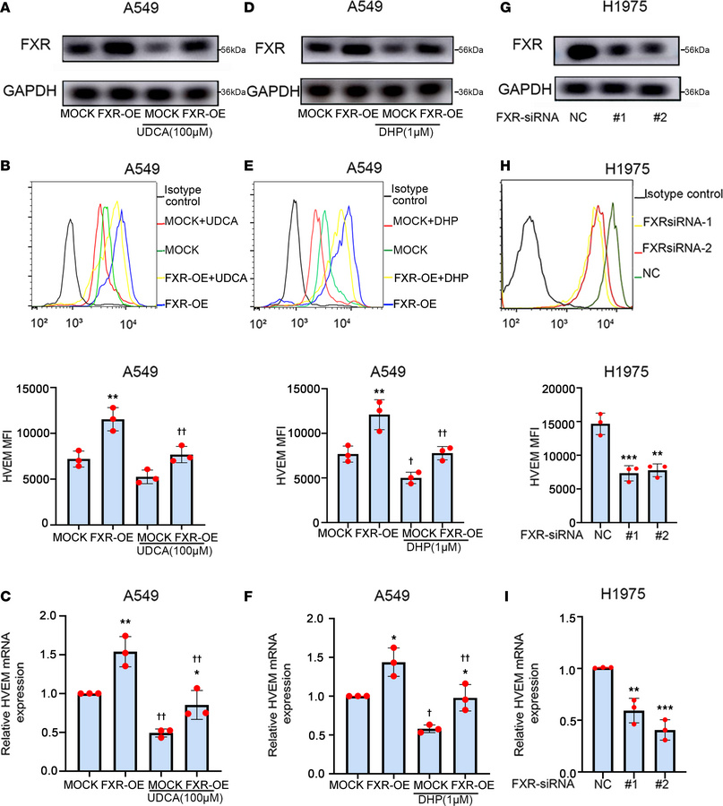 FXR upregulates HVEM expression in NSCLC cells.
(A–F) A549 cells were in...