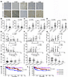 Correlation of FXR/HVEM axis with tumor immune infiltration and clinical pr