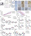 HVEM/BTLA blockade immunotherapy reactivates TME and produces antitumor act