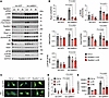 Rps6kb1 is required for ERK-induced cardiomyocyte growth.