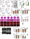 Rps6kb1 is essential for ERK-induced cardiac hypertrophy in vivo.