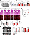 Rps6kb1 is required for pressure overload–induced cardiac hypertrophy.