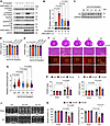 Phosphorylation of T367 and S418/T421/S424 is required for the full activat