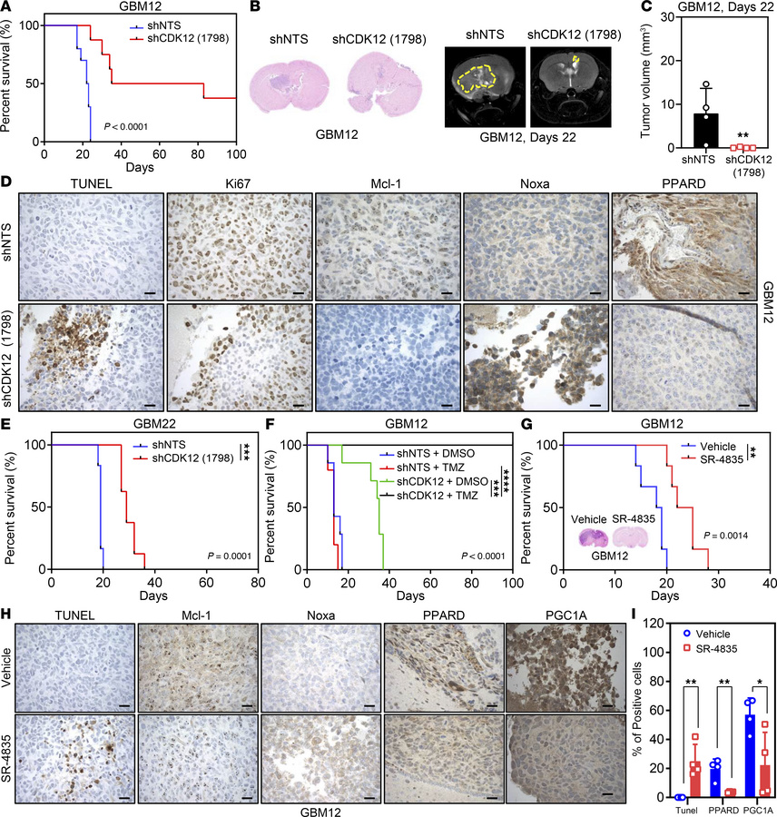 Combination treatment with CDK12 inhibition and TMZ leads to regression ...