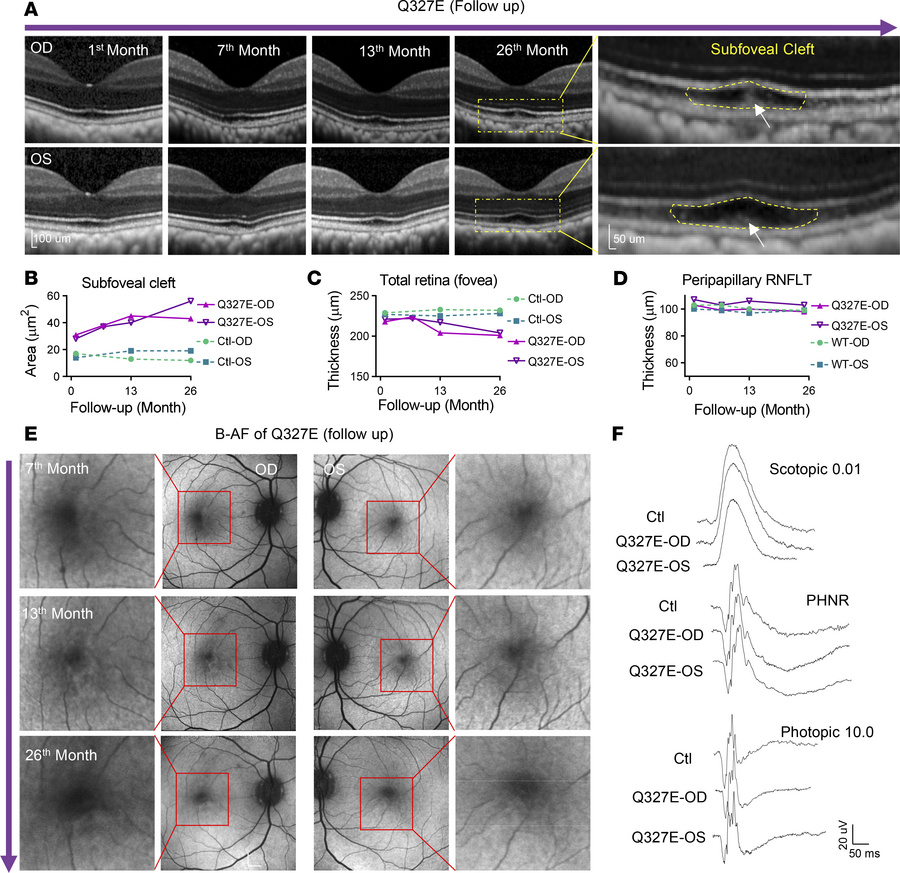 The Q327-mutant macaque exhibited clinical manifestations of Stage 1 Bes...