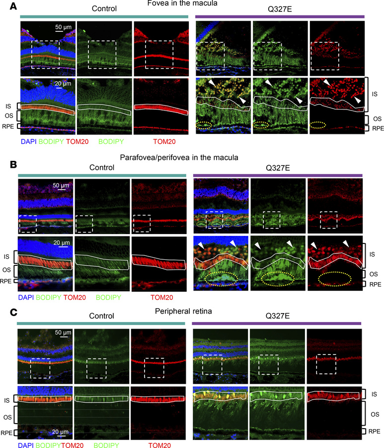 The Q327 mutant macaque exhibits mitochondrial-negative and -positive li...