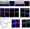 Histopathologic analysis reveals typical pathogenic features of BVMD.