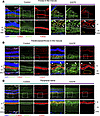 The Q327 mutant macaque exhibits mitochondrial-negative and -positive lipid
