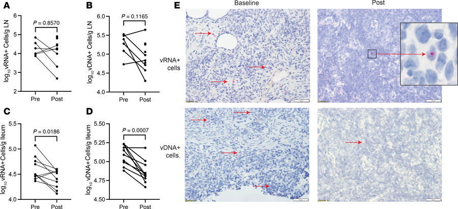 Analysis of changes in frequency of vRNA+ and vDNA+ cells in LTs.
(A) An...
