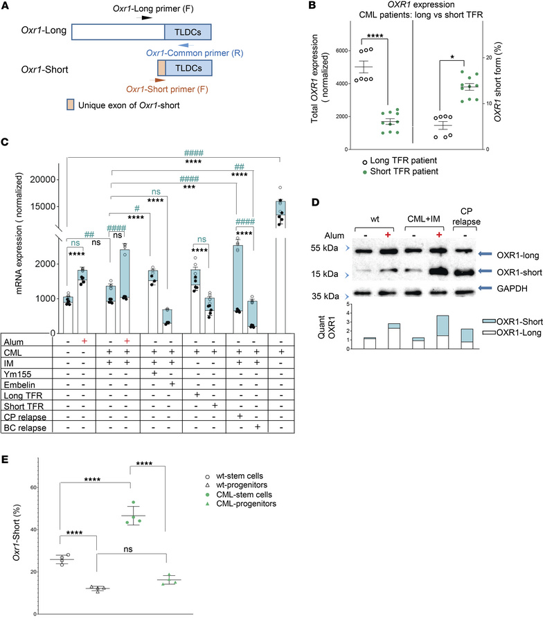 Expression of the short OXR1 isoform is associated with CML relapse.
(A)...