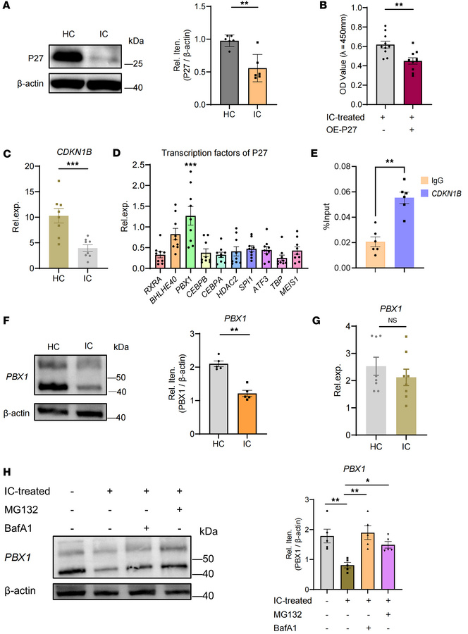Deficiency of PBX1 drives MC proliferation.
(A) Immunoblotting of P27 pr...