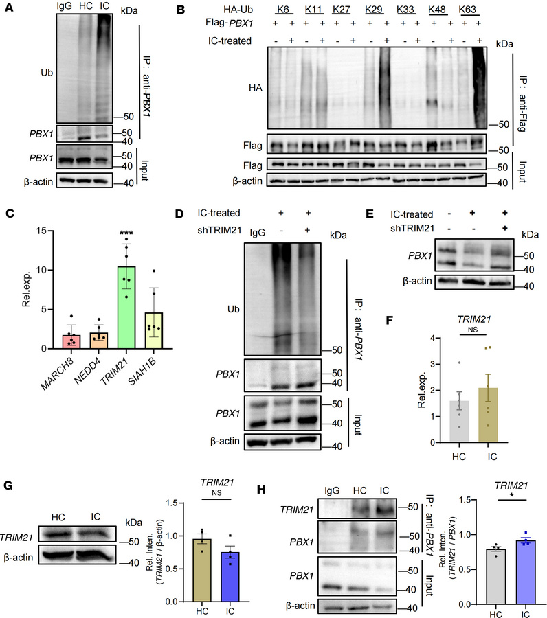 Ubiquitination of PBX1 accounts for its deficiency in MCs.
(A) The endog...