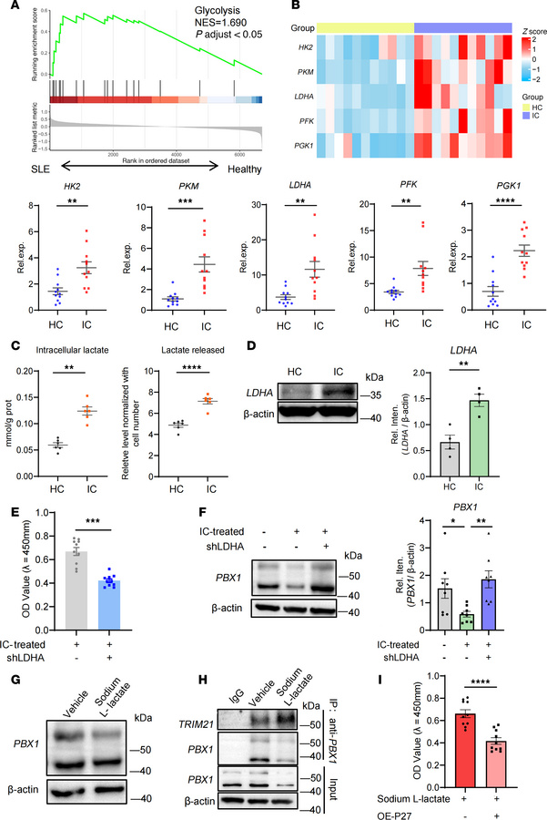 Lactate promotes PBX1 ubiquitination in MCs.
(A) Gene set enrichment ana...