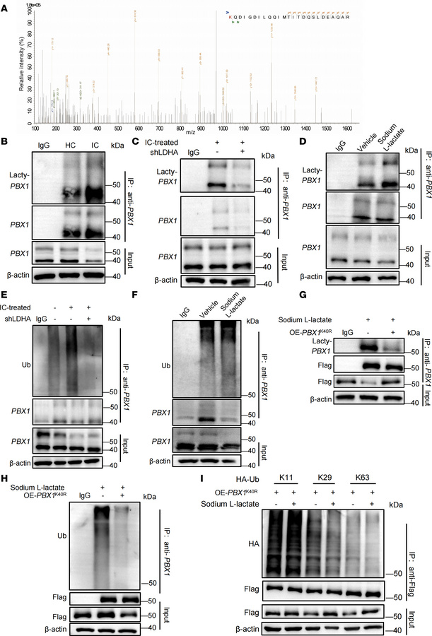 PBX1 lactylation controls its ubiquitination in MCs.
(A) HEK293 cells we...