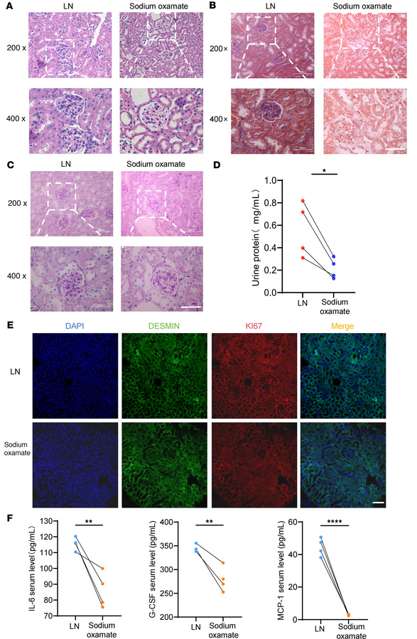 Targeting lactate ameliorates LN in humanized chimeras.
Humanized LN chi...